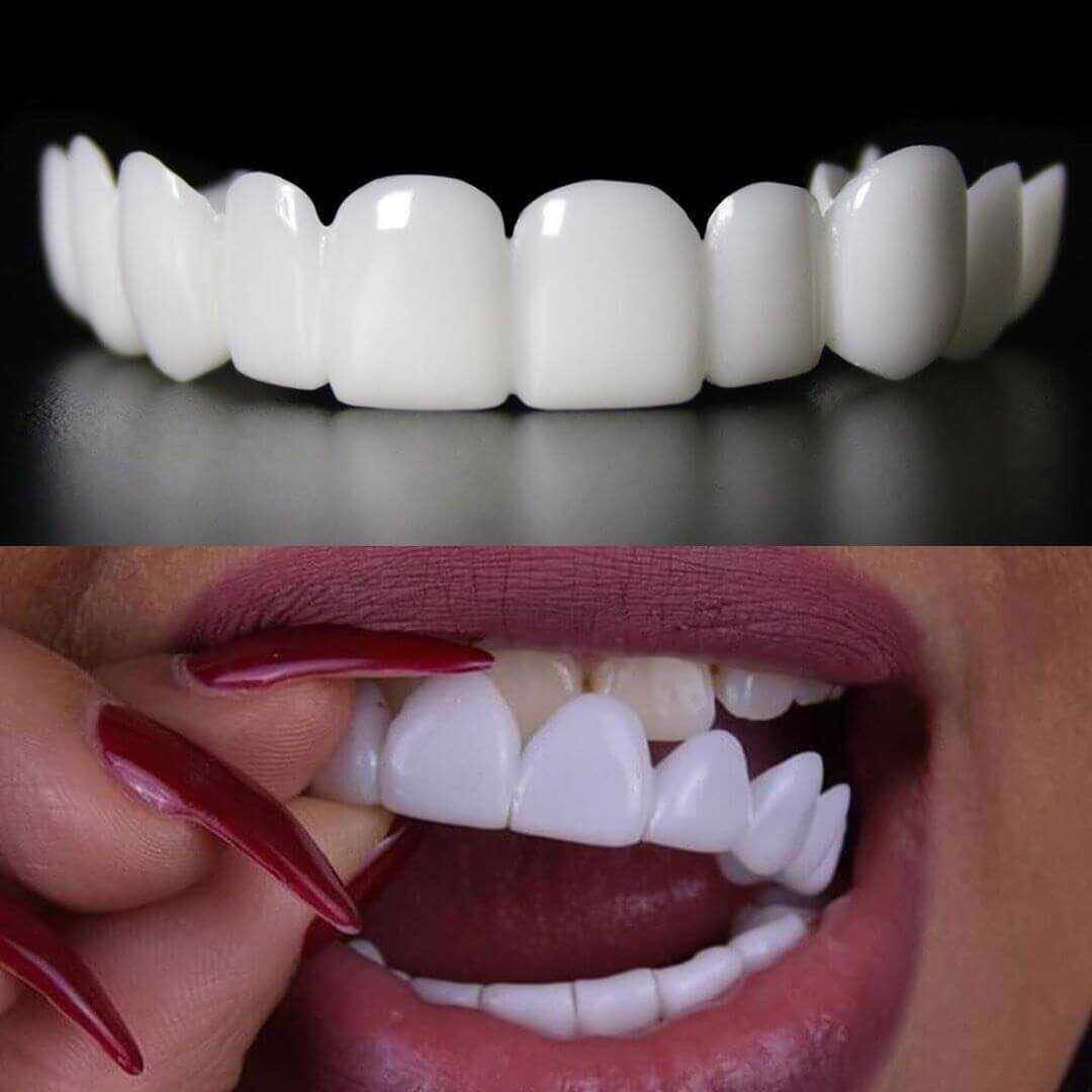 Faccette Dentali - Sorridi di nuovo con sicurezza